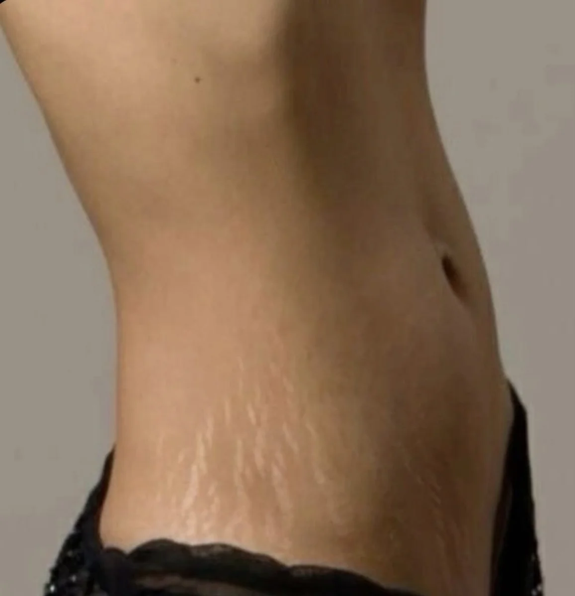 HIEMT PRO Body Sculpting в Праге — неинвазивная коррекция фигуры и укрепление мышц